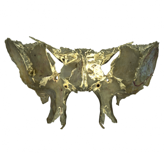 蝶骨Sphenoid Bone