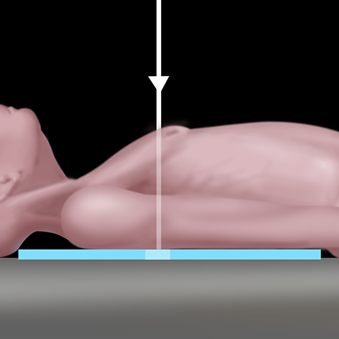 Positioning for AP Chest Radiograph [1 of 2]
