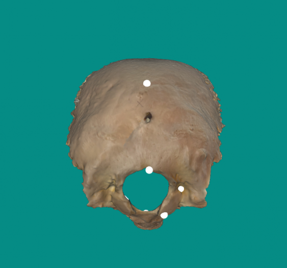 枕骨occipital bone