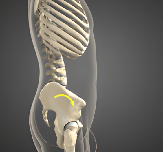 骨盆前倾Anterior Pelvic tilt