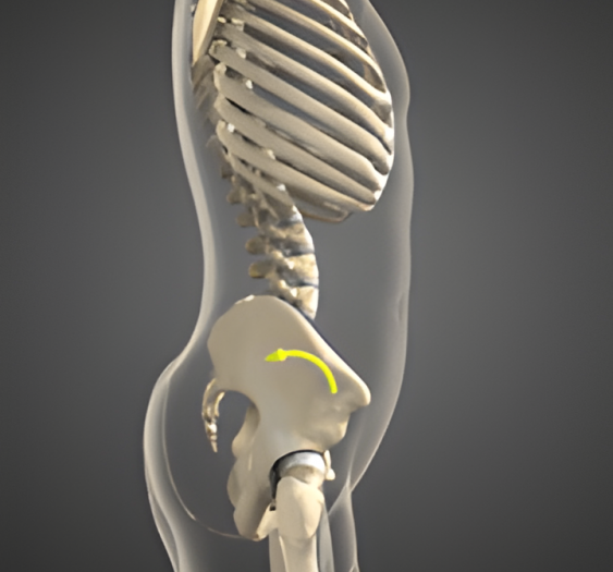 骨盆后倾Posterior pelvic tilt