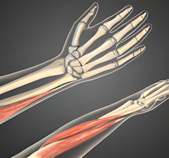 尺侧偏斜（三）Ulnar deviation