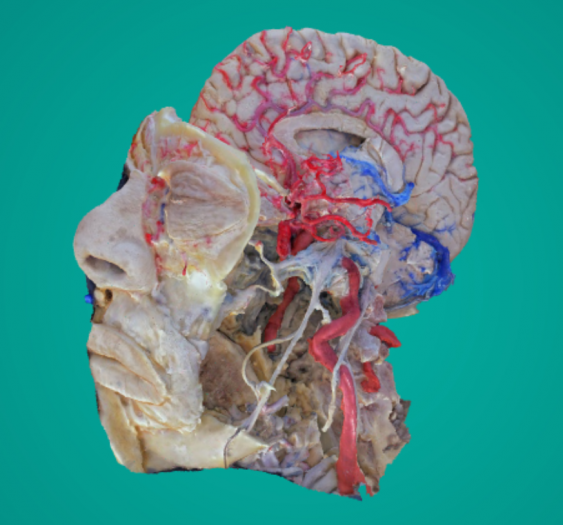 脑动脉Brain Arteries