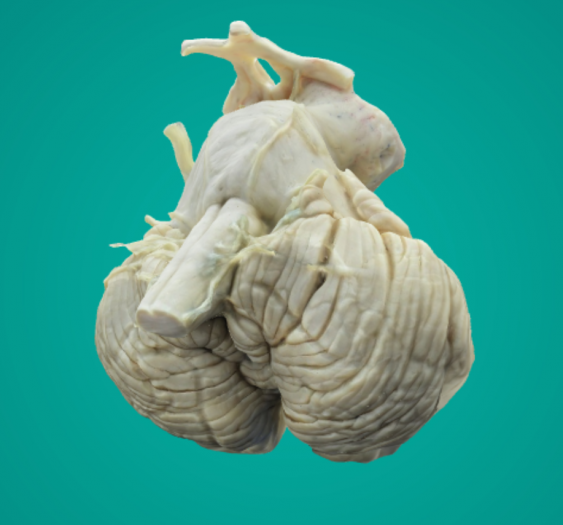 脑干Brainstem