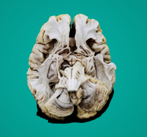下丘脑Hypothalamus