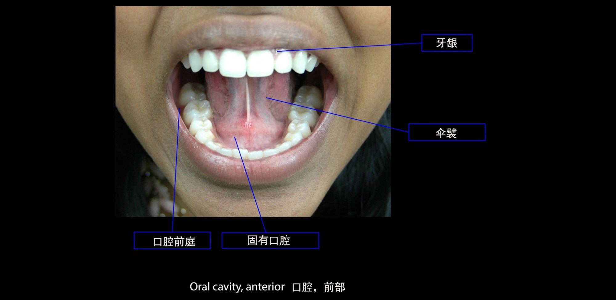 口腔前庭、牙齿和牙龈以及口腔本身
