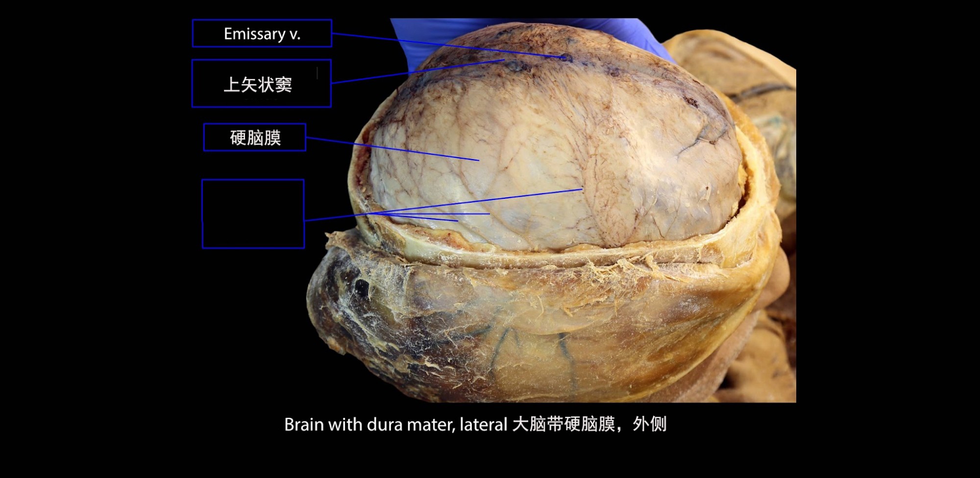 大脑，有硬脑膜