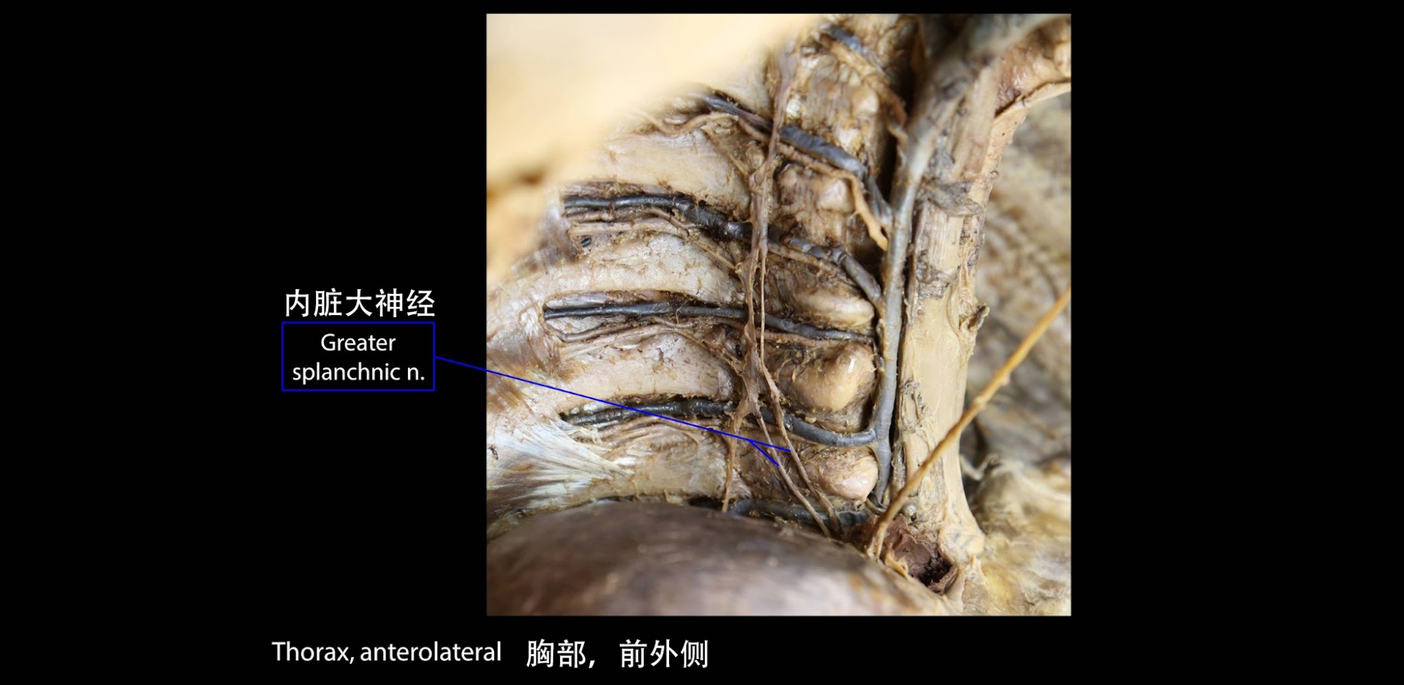 胸交感干的内脏大神经