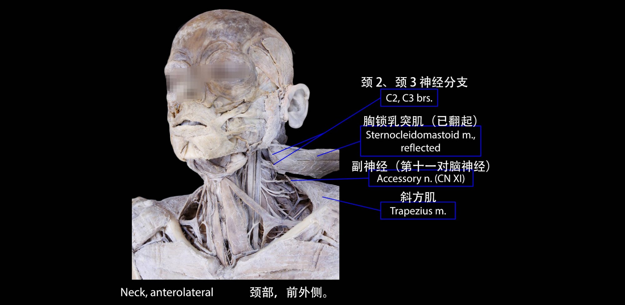 副神经
