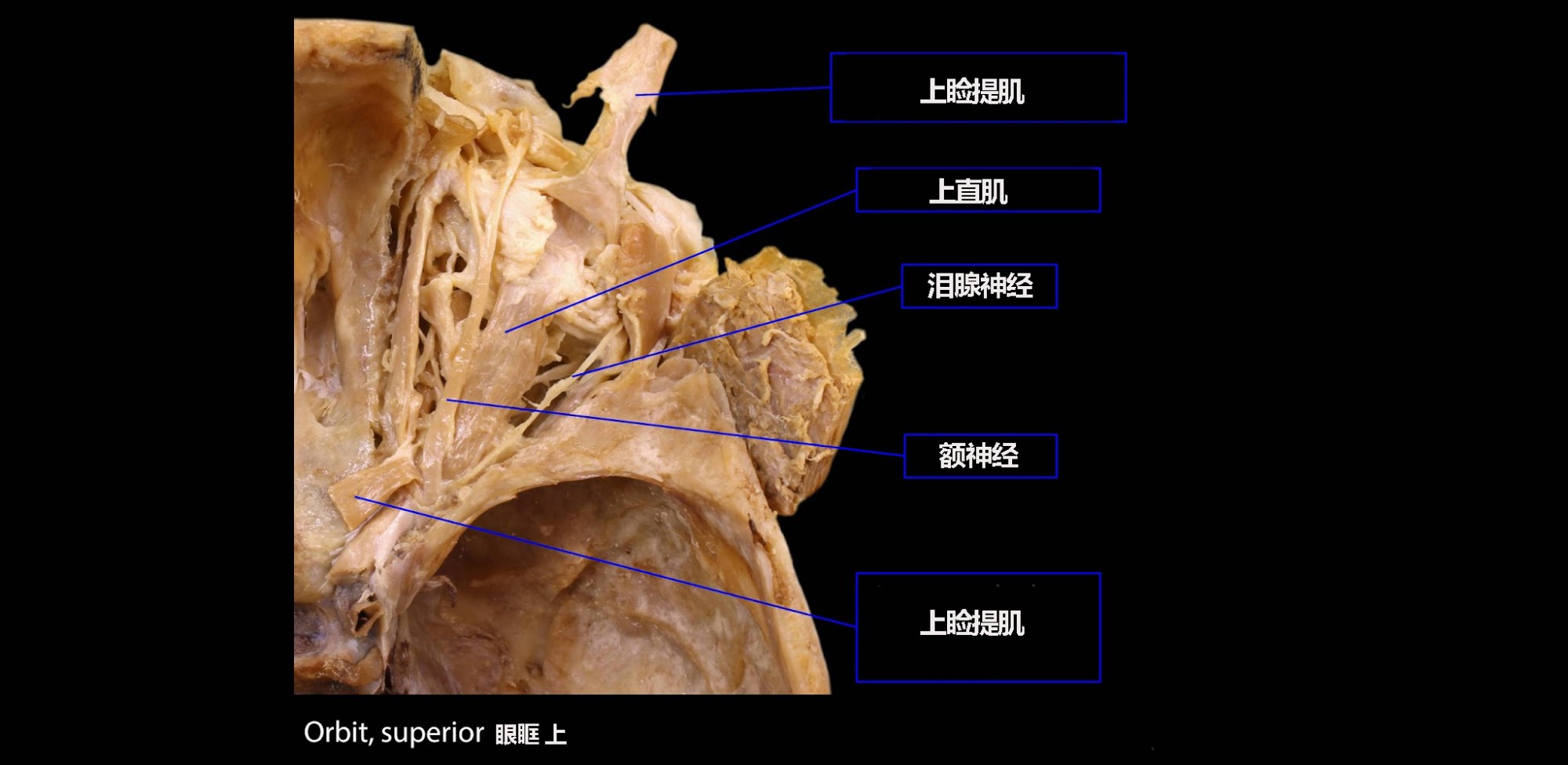 上眼眶Superior view of orbit