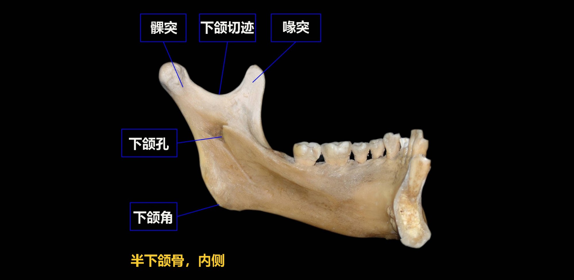 下颌骨和下颌孔支