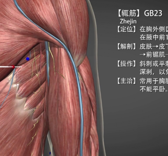 【辄筋】GB23 Zhejin