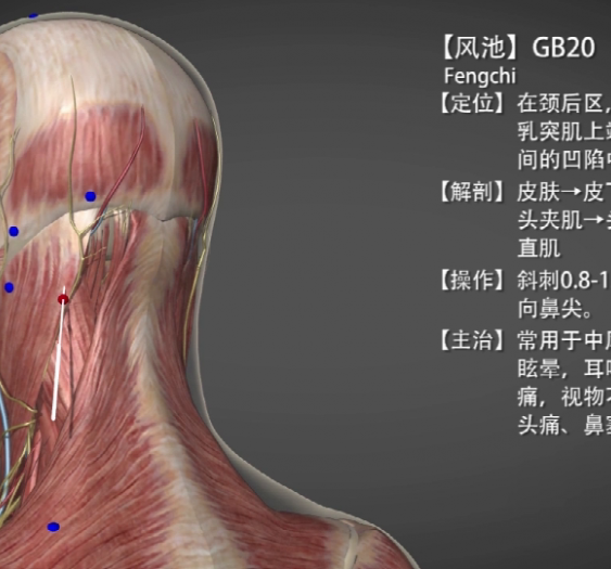 【风池】GB20 Fengchi