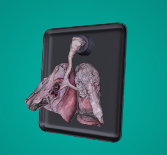 带支气管和气管的肺Lungs with Bronchi and Trachea