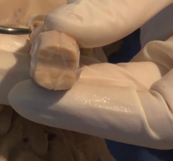 锥体束的皮质脊髓束